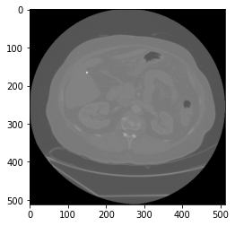 Processing DICOM File In Python With Pydicom | Martin (Qing) Ma